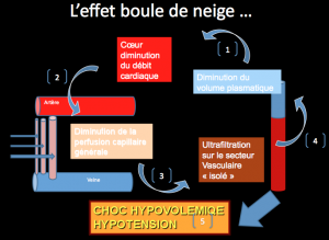 SATURATION et DIALYSE: Intérêt de la saturation en oxygène en ligne lors de  l'épuration rénale extracorporelle sanguine 